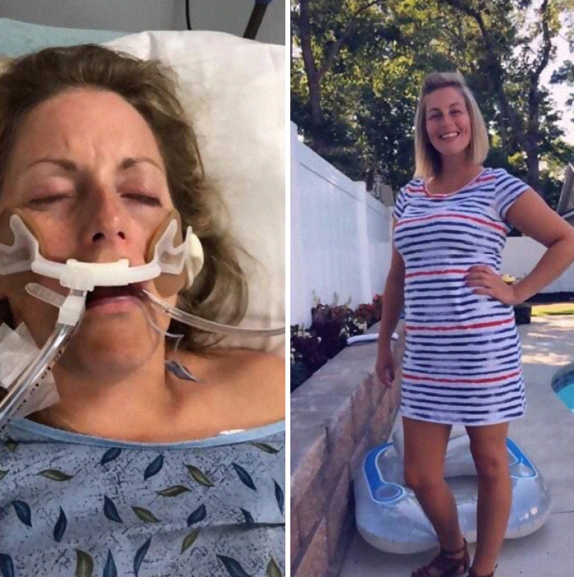 25 photos of people before and after overcoming addiction 25 photos of people before and after overcoming addiction