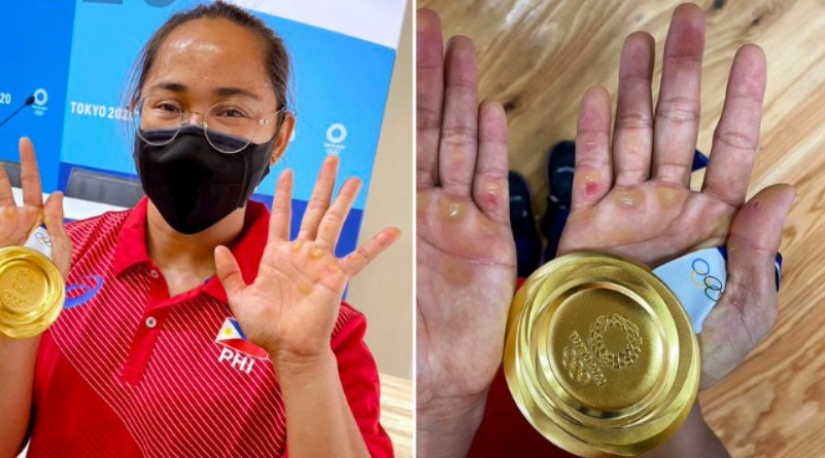 25 rare photos of Olympians showing what is happening behind the scenes of big sports 25 rare photos of Olympians showing what is happening behind the scenes of big sports
