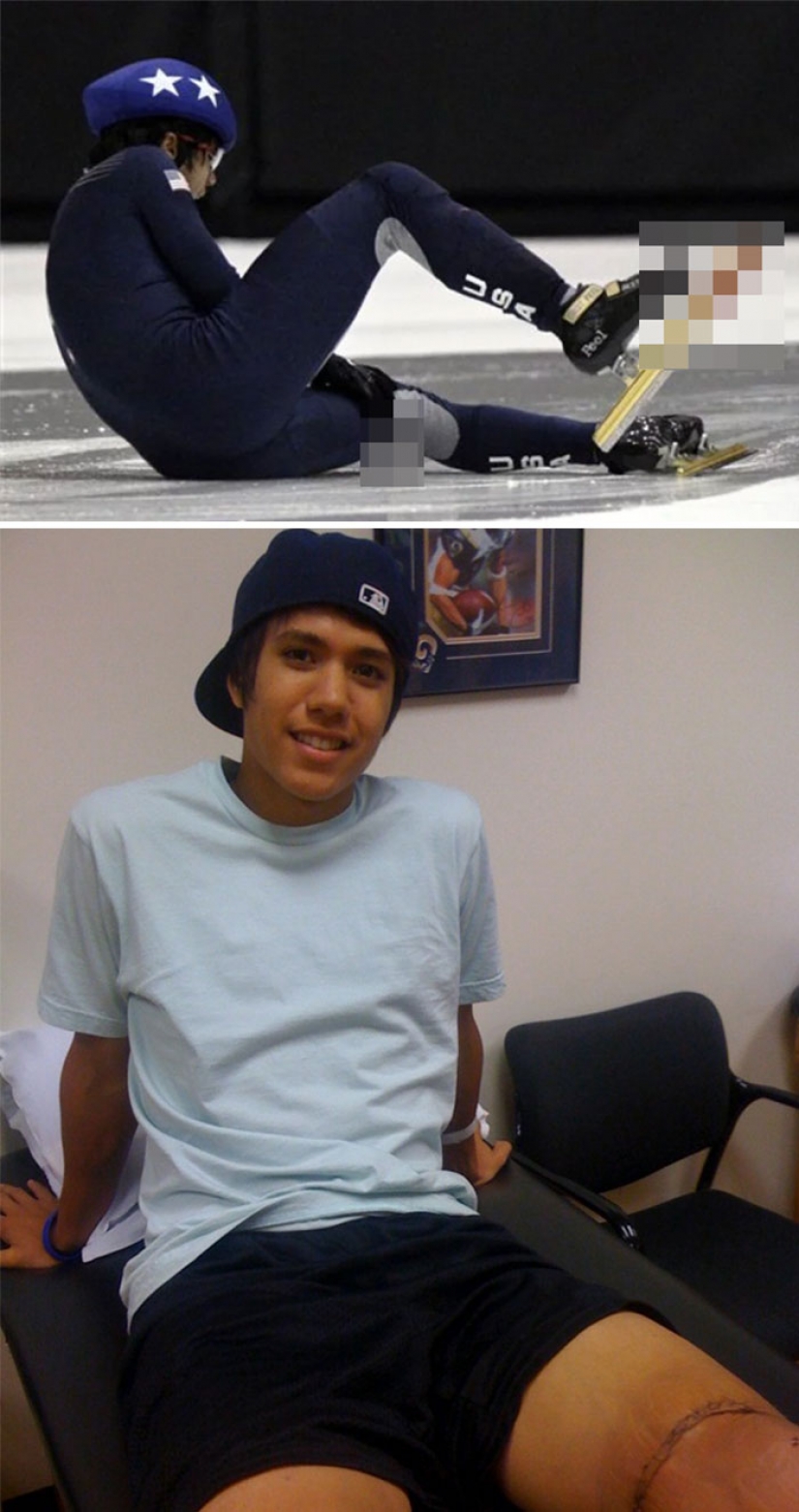 25 rare photos of Olympians showing what is happening behind the scenes of big sports 25 rare photos of Olympians showing what is happening behind the scenes of big sports