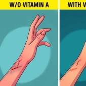 6 Signs Your Body Needs More Vitamin A