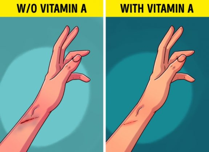 6 Signs Your Body Needs More Vitamin A