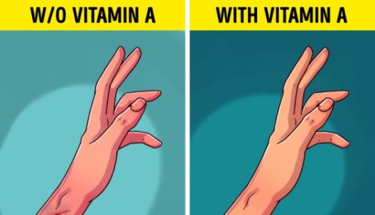 6 Signs Your Body Needs More Vitamin A 6 Signs Your Body Needs More Vitamin A