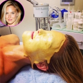 7 horribles procedimientos cosméticos populares en Hollywood 7 horribles procedimientos cosméticos populares en Hollywood