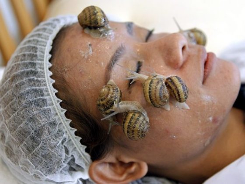 7 horribles procedimientos cosméticos populares en Hollywood