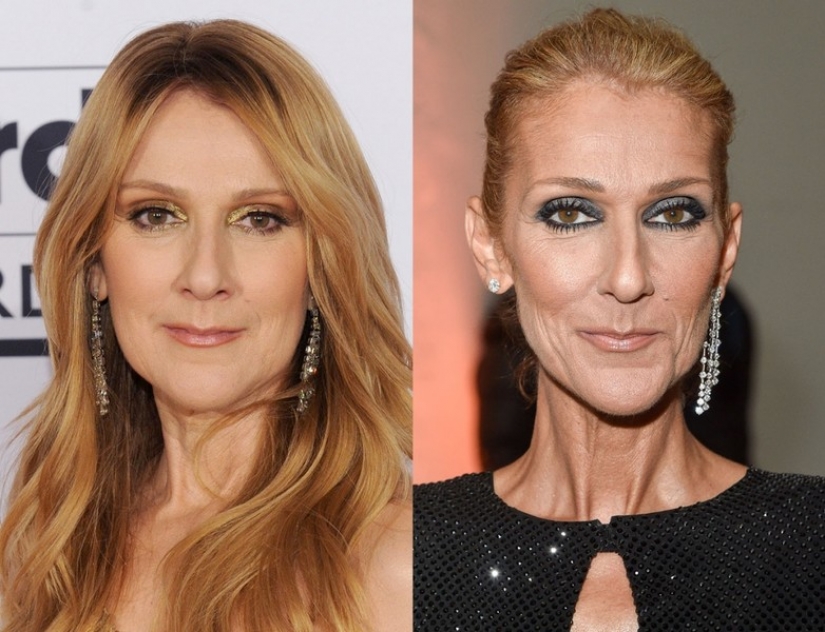 9 celebridades que la pérdida de peso ha hecho más viejo 9 celebridades que la pérdida de peso ha hecho más viejo