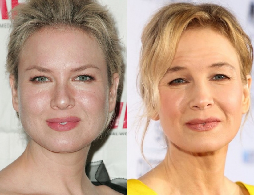 9 celebrities that weight loss has made older