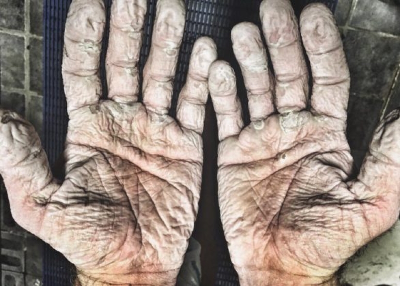 9 fotos que muestran la fuerza del espíritu humano