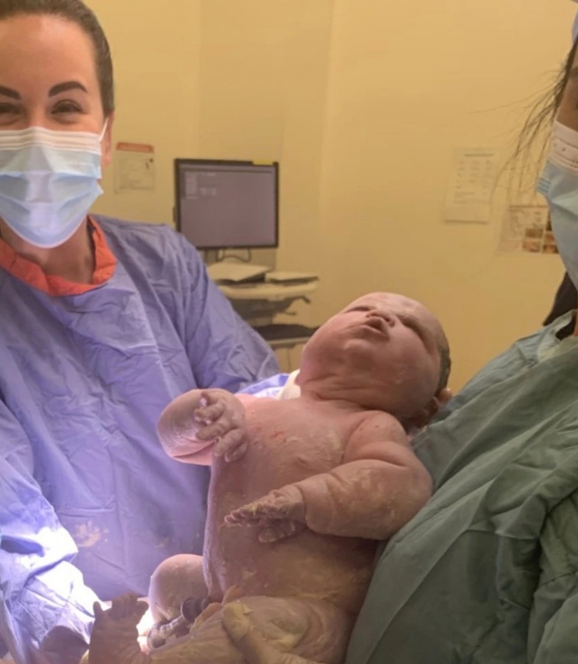A big miracle: in the UK, a baby hero weighing 6 kg was born