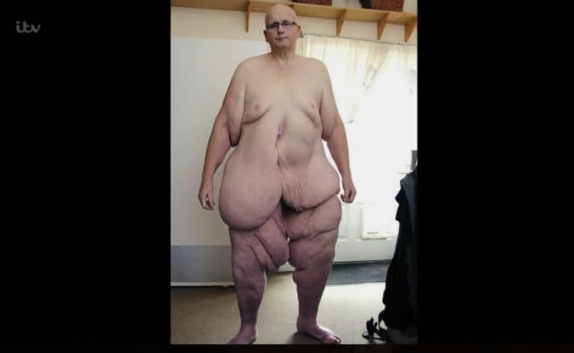 A burden on the heart: the sad story of one of the fattest people in the world A burden on the heart: the sad story of one of the fattest people in the world