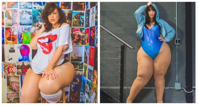 A model with a lipedema inspires others not to be ashamed of their body A model with a lipedema inspires others not to be ashamed of their body