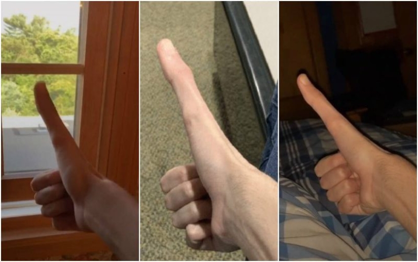 A student from the USA became a star of the social network because of an abnormally large body part A student from the USA became a star of the social network because of an abnormally large body part
