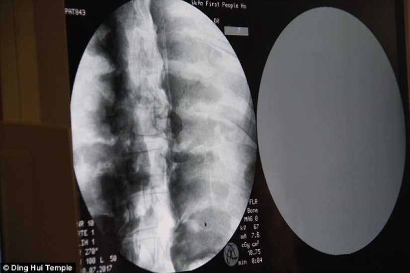 A thousand-year-old mummy of a Buddhist monk has a brain and skeleton preserved in perfect condition A thousand-year-old mummy of a Buddhist monk has a brain and skeleton preserved in perfect condition