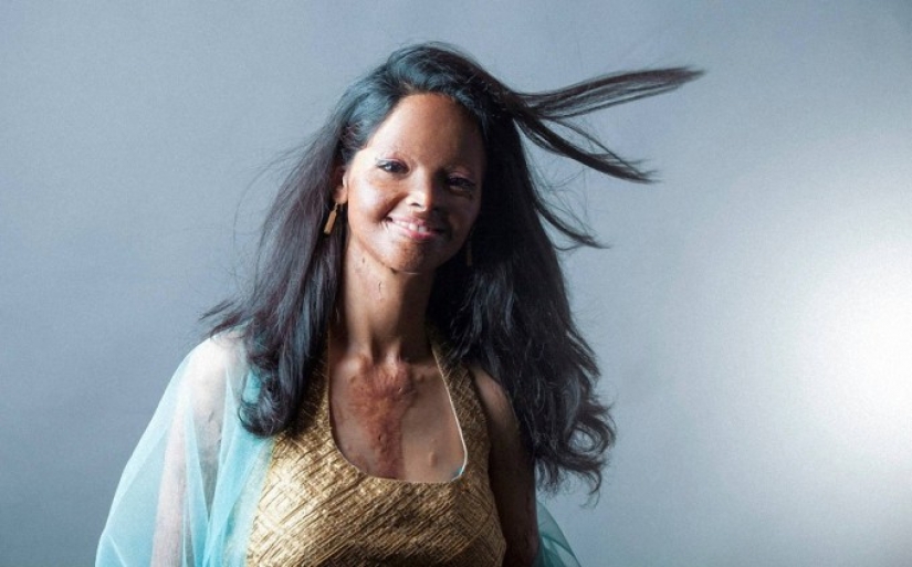 Acid mutilated models from India