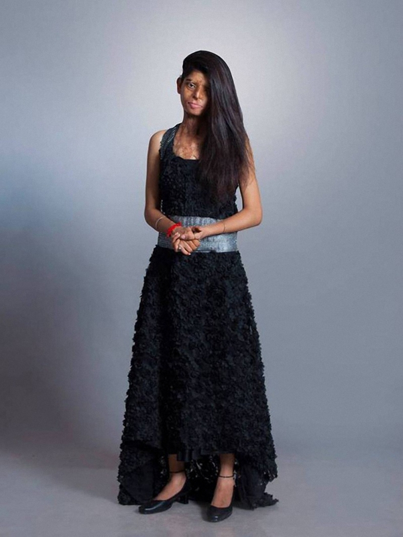 Acid mutilated models from India