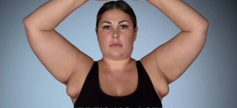 After giving birth, the American woman grew "breasts" under her arms, from which milk oozed After giving birth, the American woman grew "breasts" under her arms, from which milk oozed