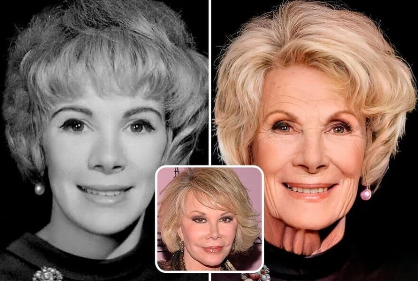 Artificial intelligence has shown how the stars would have aged if not for botox and plastic