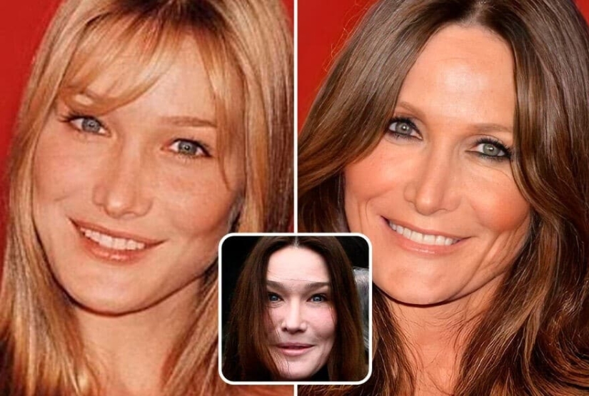 Artificial intelligence has shown how the stars would have aged if not for botox and plastic