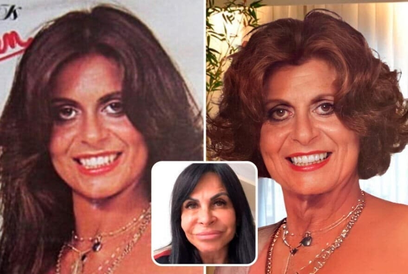 Artificial intelligence has shown how the stars would have aged if not for botox and plastic