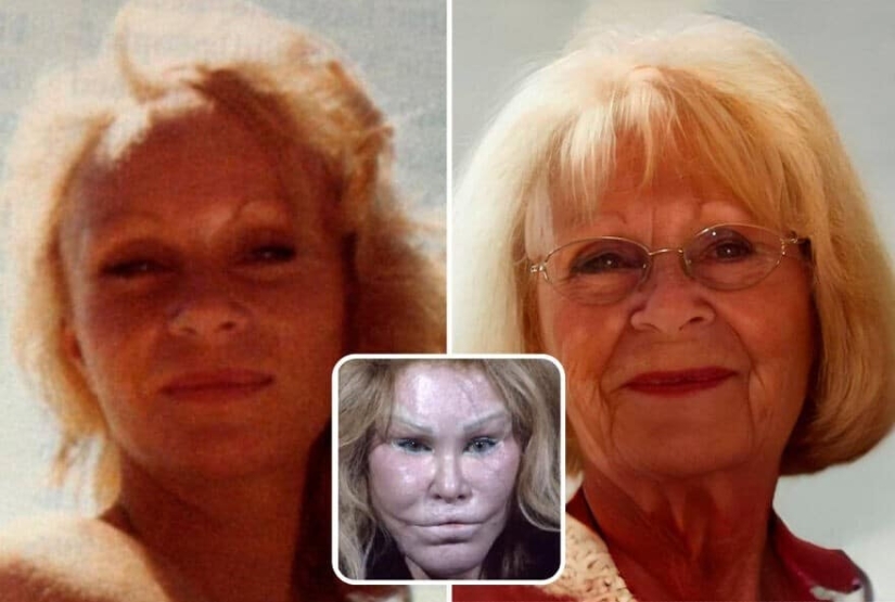 Artificial intelligence has shown how the stars would have aged if not for botox and plastic