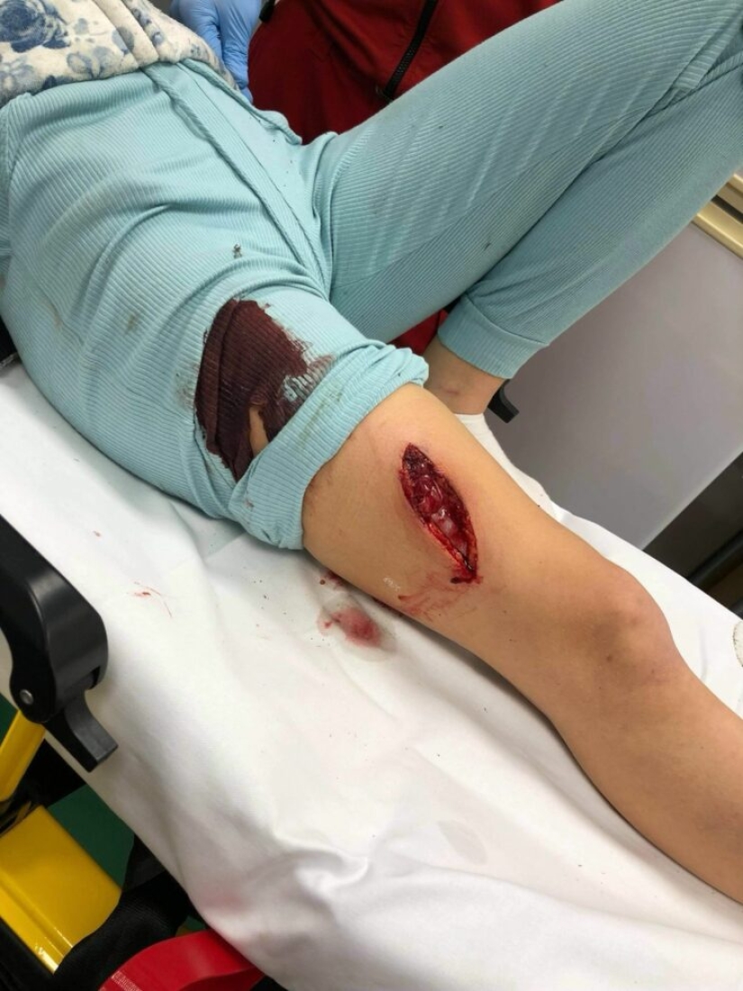 Blogger noruego casi muere durante una selfie con un cerdo doméstico