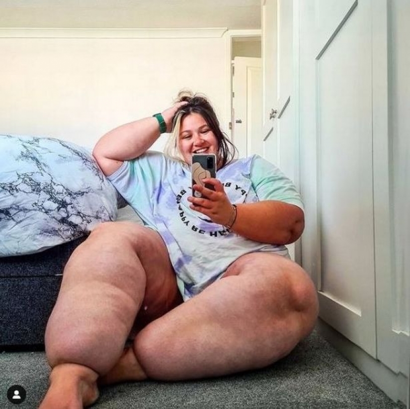 British woman exhausted herself with diets to make her legs lose weight, but it was a disease British woman exhausted herself with diets to make her legs lose weight, but it was a disease