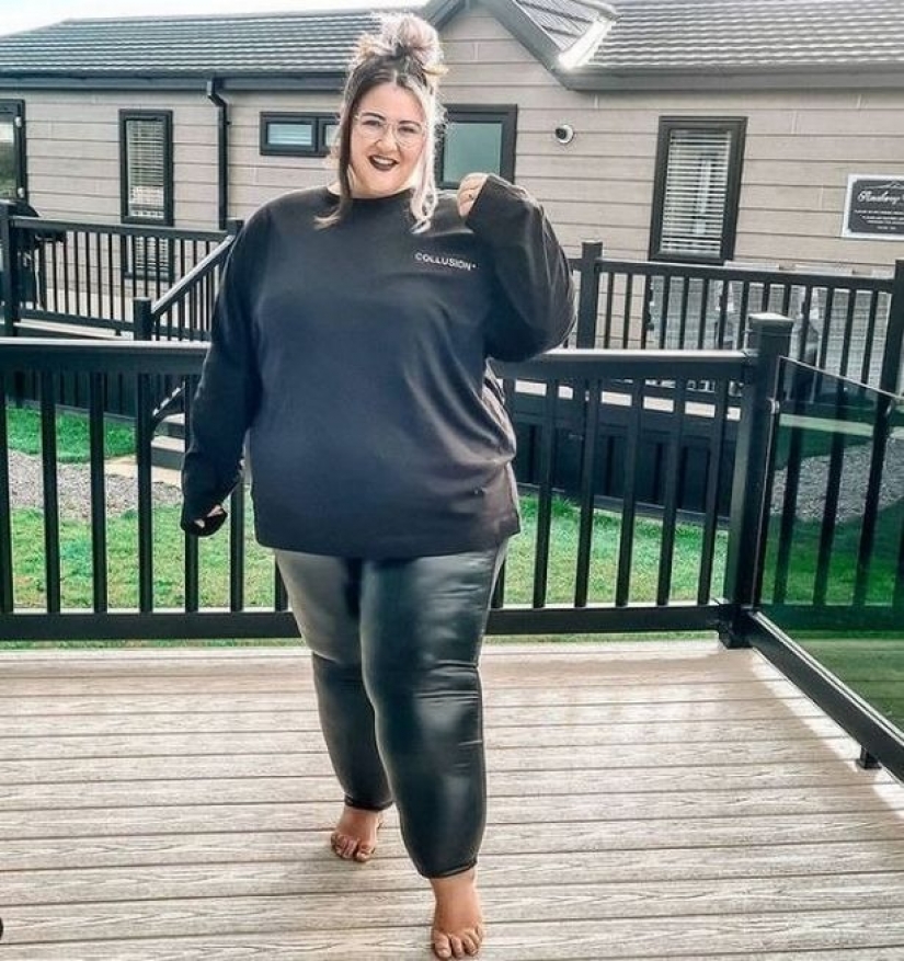 British woman exhausted herself with diets to make her legs lose weight, but it was a disease British woman exhausted herself with diets to make her legs lose weight, but it was a disease
