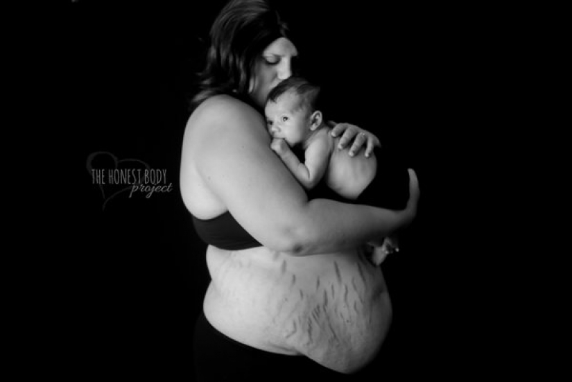 Candid photo project: how to actually look women after childbirth Candid photo project: how to actually look women after childbirth