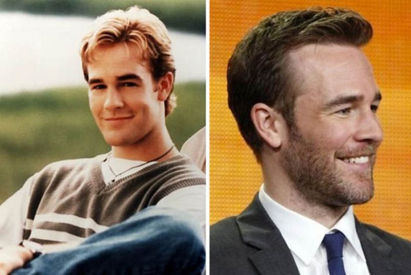 Celebrities — what they were like in the 90s