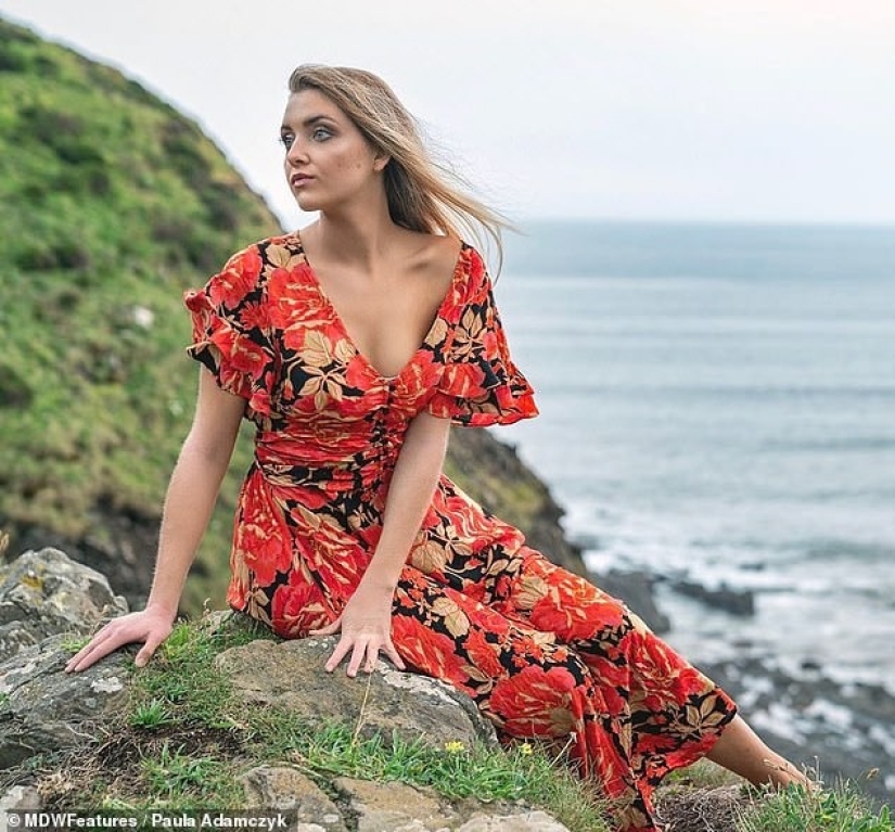 Clean food - clean skin: model cured of eczema by becoming a vegetarian