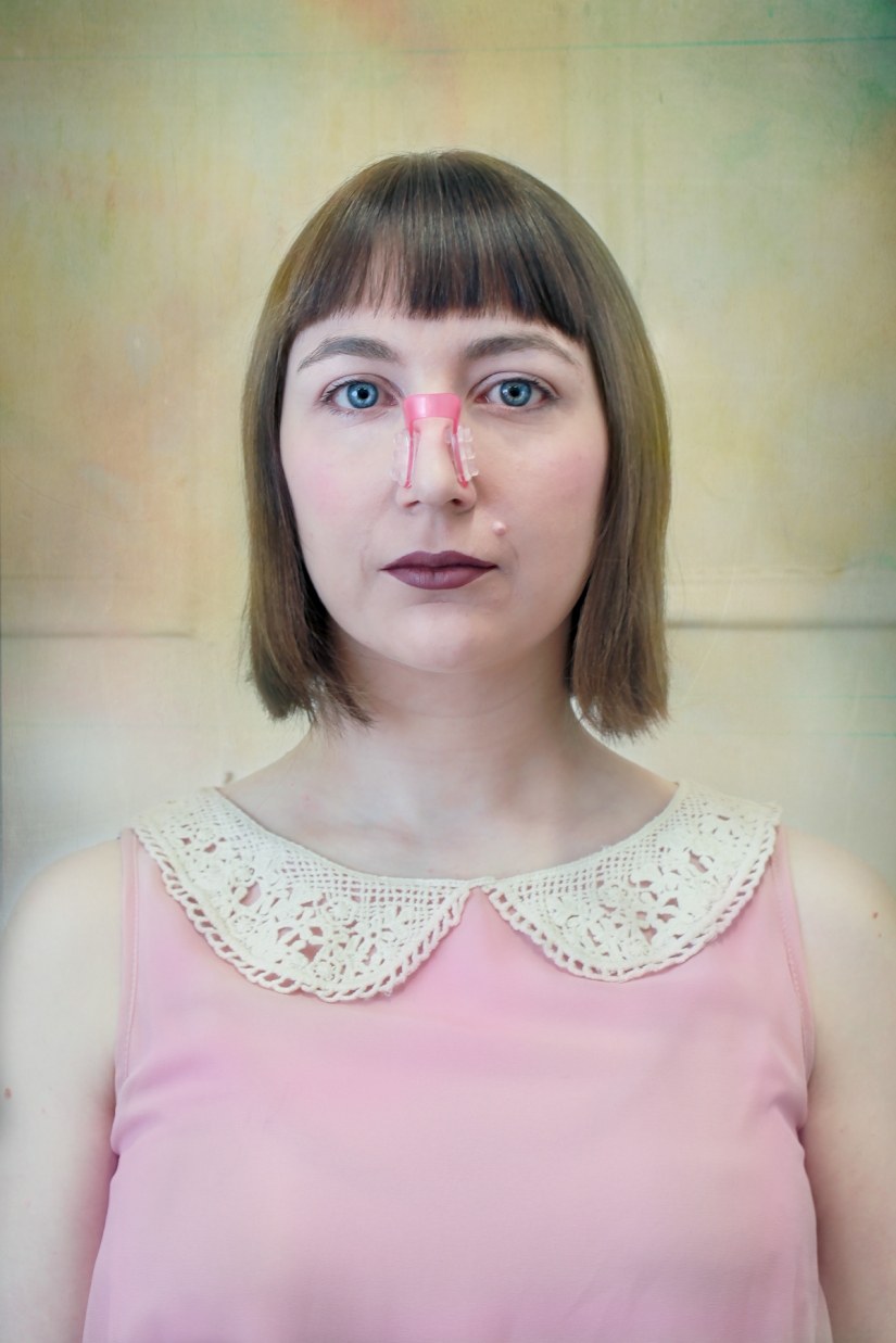 Clothespin on the nose and duck lips: what women are ready for for the sake of beauty and youth Clothespin on the nose and duck lips: what women are ready for for the sake of beauty and youth