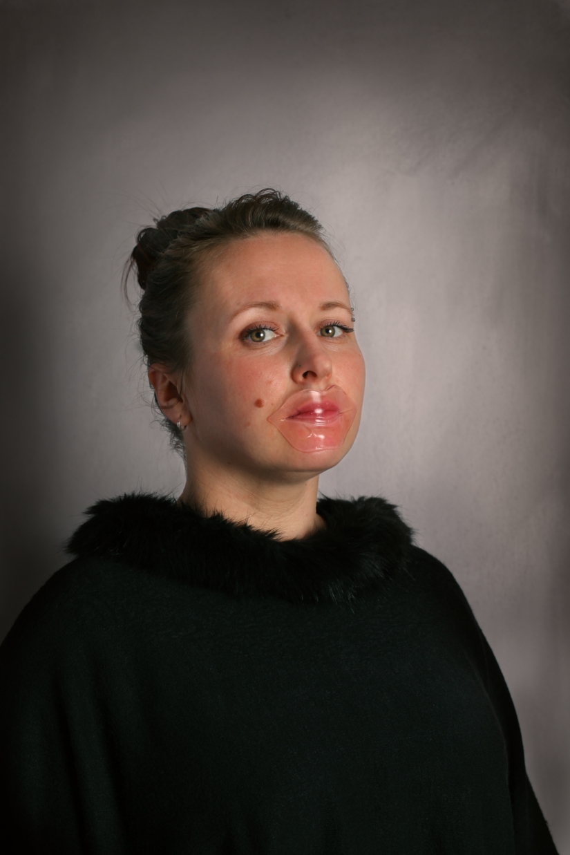 Clothespin on the nose and duck lips: what women are ready for for the sake of beauty and youth Clothespin on the nose and duck lips: what women are ready for for the sake of beauty and youth