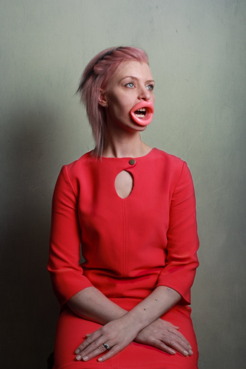 Clothespin on the nose and duck lips: what women are ready for for the sake of beauty and youth Clothespin on the nose and duck lips: what women are ready for for the sake of beauty and youth