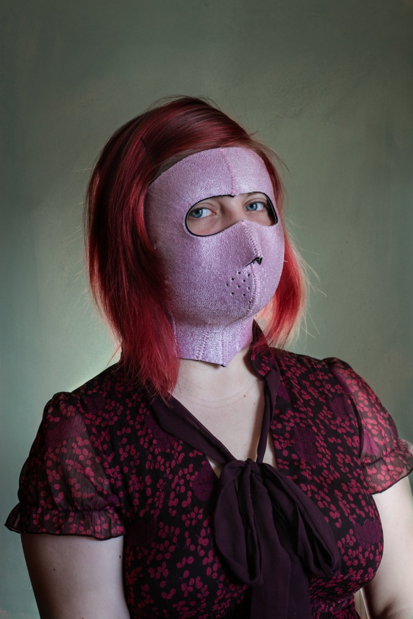 Clothespin on the nose and duck lips: what women are ready for for the sake of beauty and youth Clothespin on the nose and duck lips: what women are ready for for the sake of beauty and youth