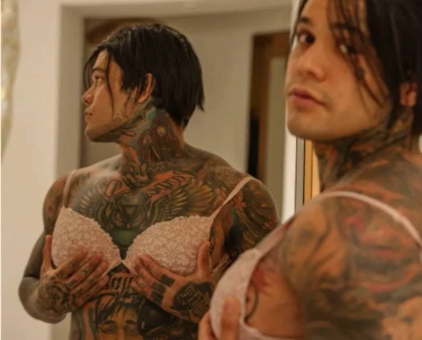 Columbian blogger lost a bet and made themselves silicone breast Columbian blogger lost a bet and made themselves silicone breast