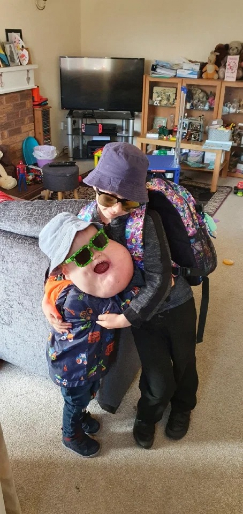 Con fe en lo mejor: un niño de 4 años con un tumor en la cara no pierde el corazón, a pesar de la enfermedad