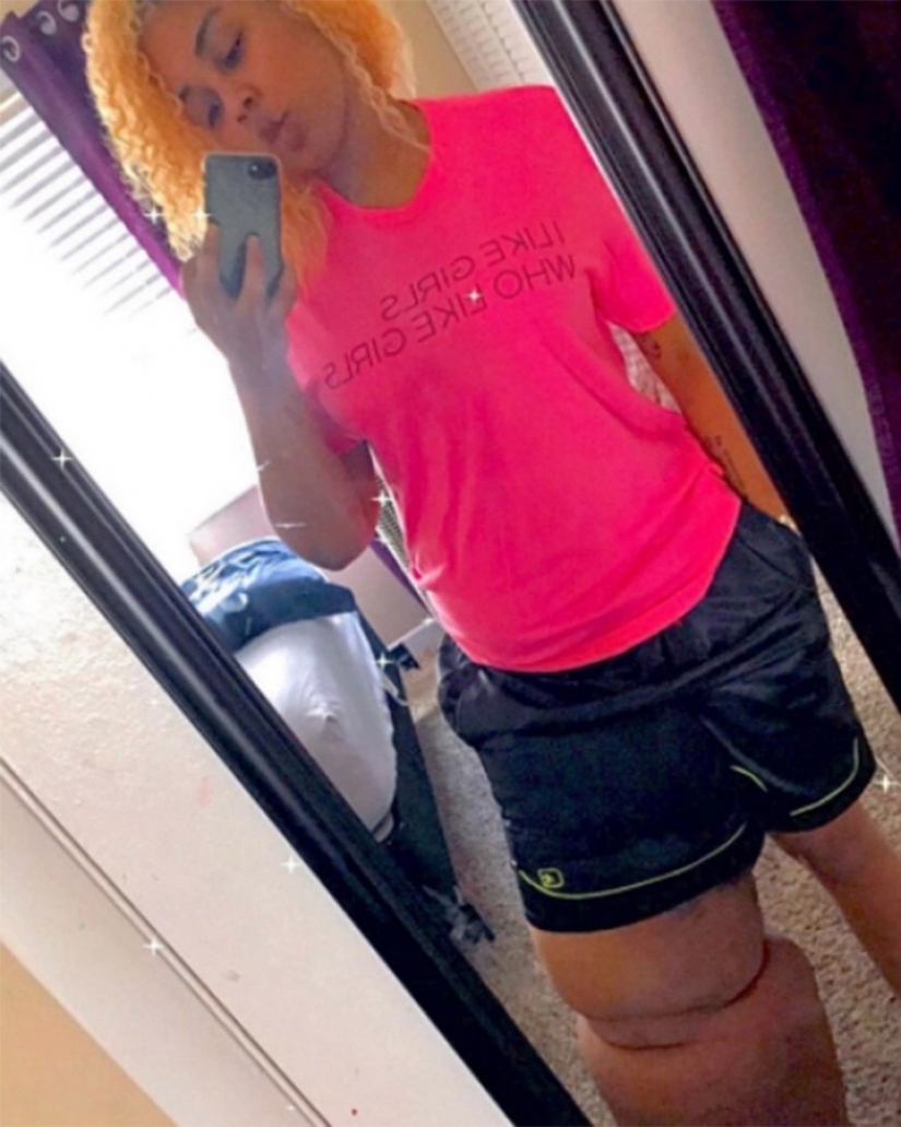 "Cortar la pierna!": how an American woman with a 45-kilogram limb learned to love herself