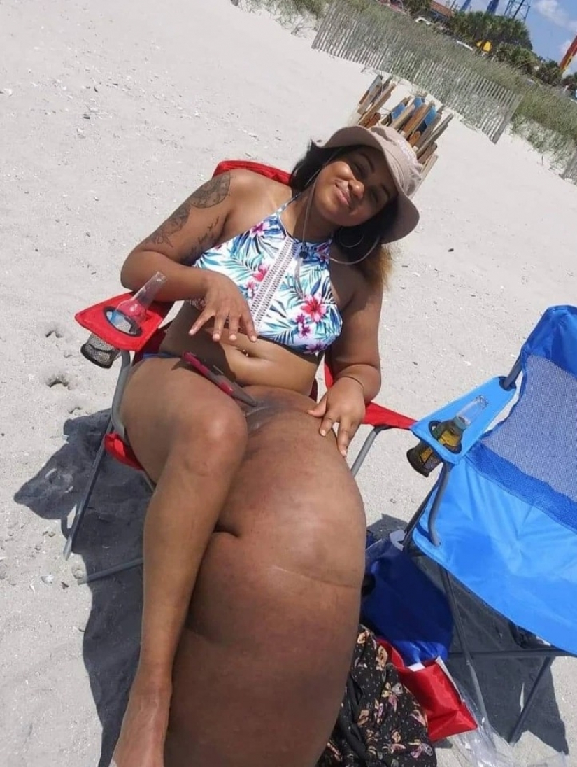 "Cortar la pierna!": how an American woman with a 45-kilogram limb learned to love herself