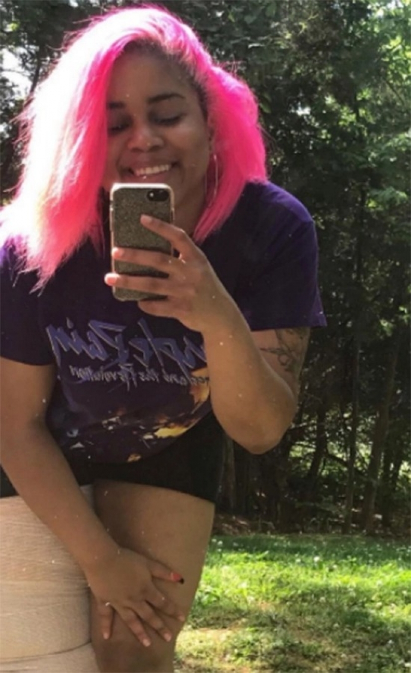 "Cortar la pierna!": how an American woman with a 45-kilogram limb learned to love herself