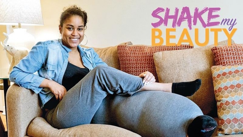 "Cortar la pierna!": how an American woman with a 45-kilogram limb learned to love herself