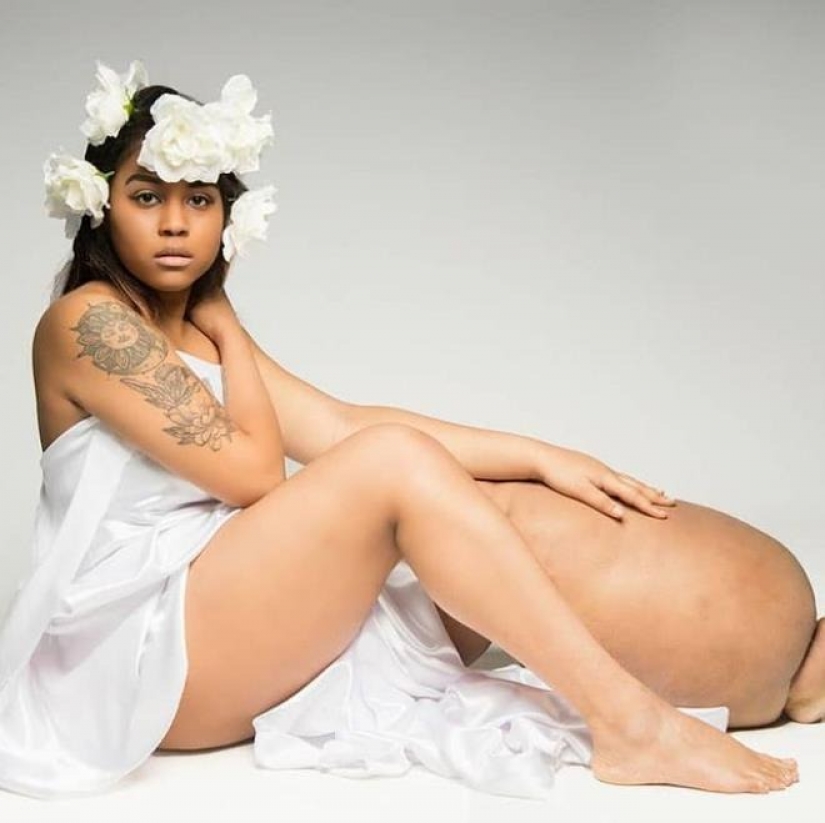 "Cortar la pierna!": how an American woman with a 45-kilogram limb learned to love herself