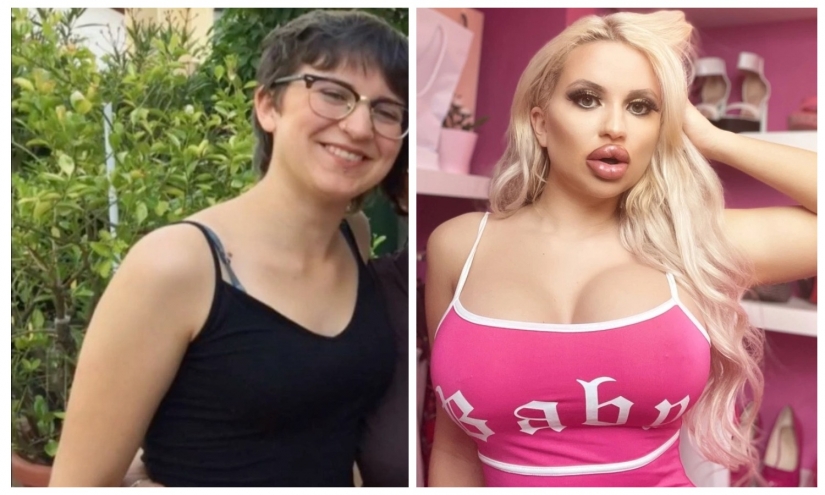 De un ratón gris a la reina de la silicona: una mujer alemana se convirtió en una Barbie viva debido a la rigurosidad de los padres