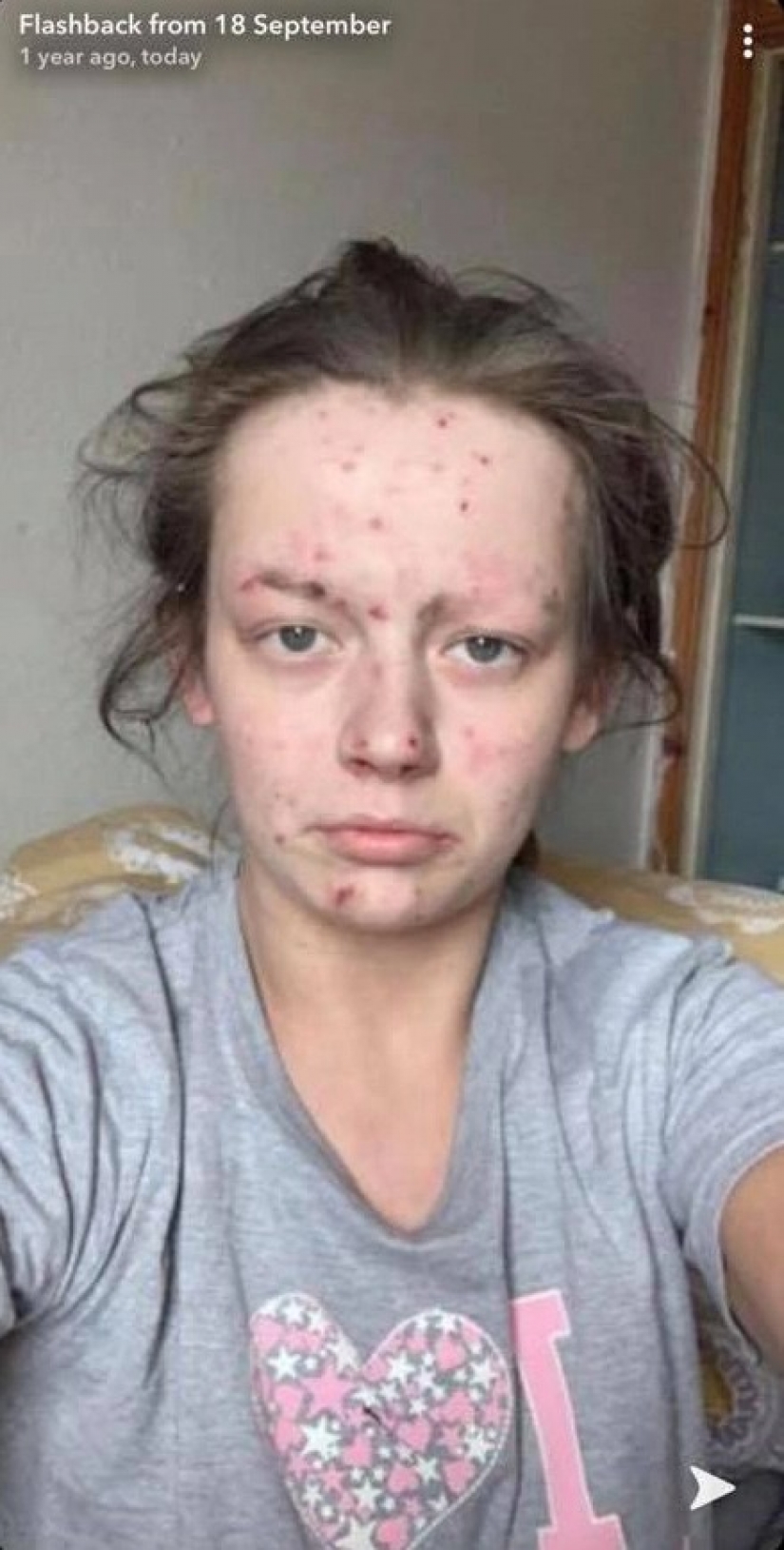 De una rana a una princesa: una ex drogadicta se convirtió en una belleza, librándose de la adicción De una rana a una princesa: una ex drogadicta se convirtió en una belleza, librándose de la adicción