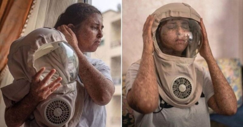 Debido a una rara alergia al sol, una mujer de Marruecos camina en un traje espacial