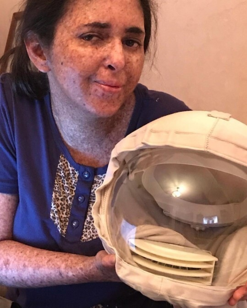 Debido a una rara alergia al sol, una mujer de Marruecos camina en un traje espacial