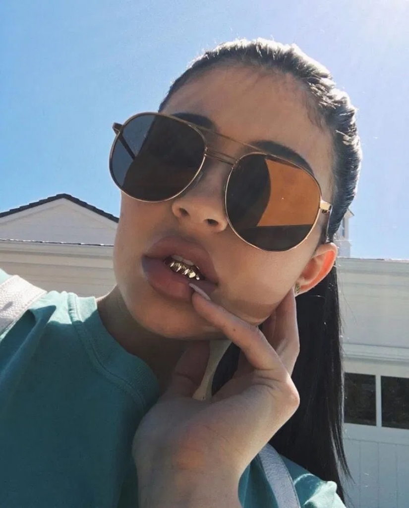 Diamante de dientes: las estrellas se jactan grizli de oro y piedras preciosas Diamante de dientes: las estrellas se jactan grizli de oro y piedras preciosas