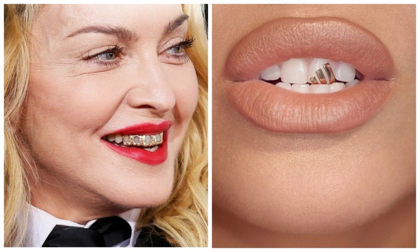 Diamond teeth: stars boast grizli of gold and precious stones