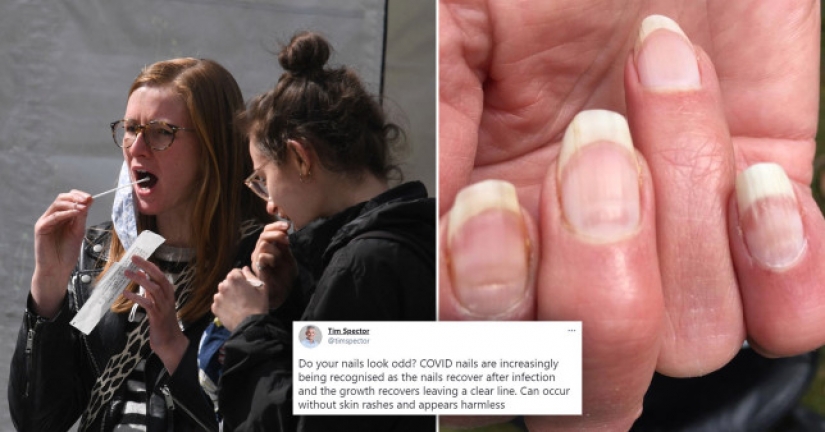 Doctors called an unexpected symptom that you have suffered a coronavirus Doctors called an unexpected symptom that you have suffered a coronavirus