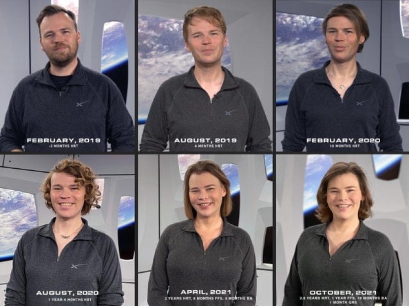 El género no es una oración: 22 fotos de personas transgénero antes y después del cambio de sexo El género no es una oración: 22 fotos de personas transgénero antes y después del cambio de sexo