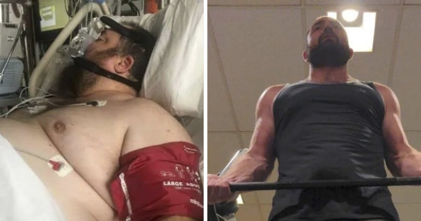 El hombre se decepcionó tanto que casi murió, pero la dieta y los deportes lo salvaron y lo hicieron guapo