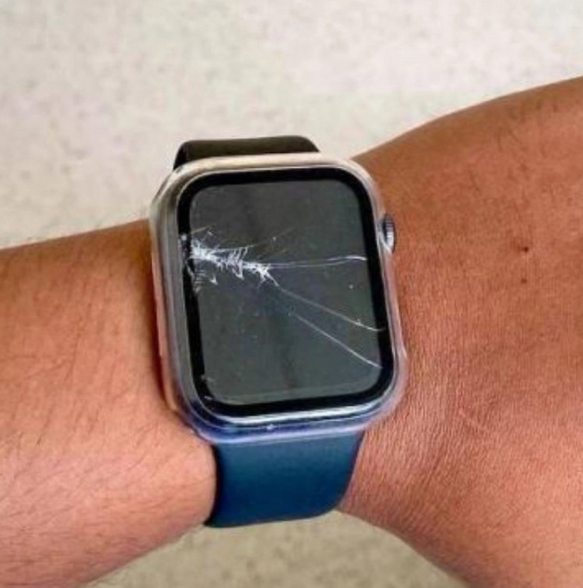 El reloj inteligente salvó la vida del propietario después de un grave accidente en una carretera desierta El reloj inteligente salvó la vida del propietario después de un grave accidente en una carretera desierta
